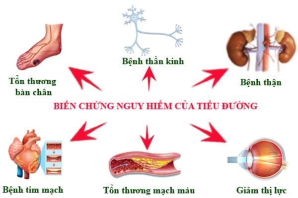 Bệnh tiểu đường điều trị như thế nào ? Bien-chung-cua-benh-tieu-duong