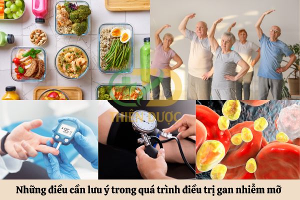 Nhung-dieu-can-luu-y-trong-qua-trinh-dieu-tri-gan-nhiem-mo