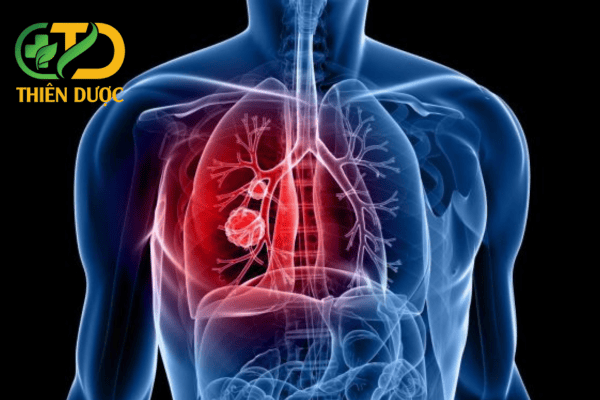 Vien-uong-dong-trung-ha-thao-ho-tro-chuc-nang-phoi