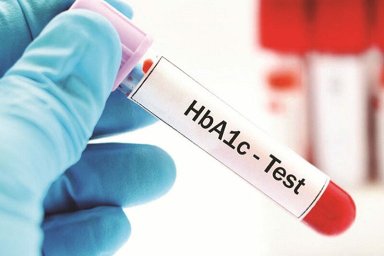 Phuong-phap-xet-nghiem-hemoglobin-A1C